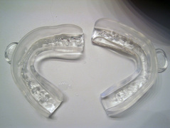 Brilliant HD - Deluxe Teeth Whitening Kit Mouth Pieces